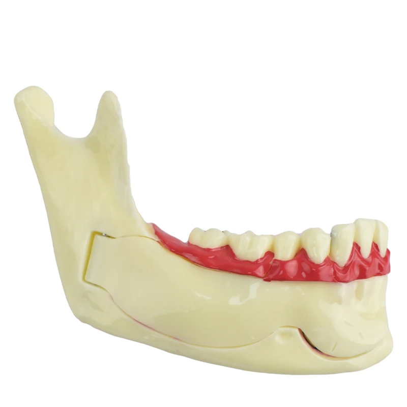 Dental Endodontic Treatment Model Right Side Anatomy of Gums Study Dental Materials Mandible Tissue Dental Materials